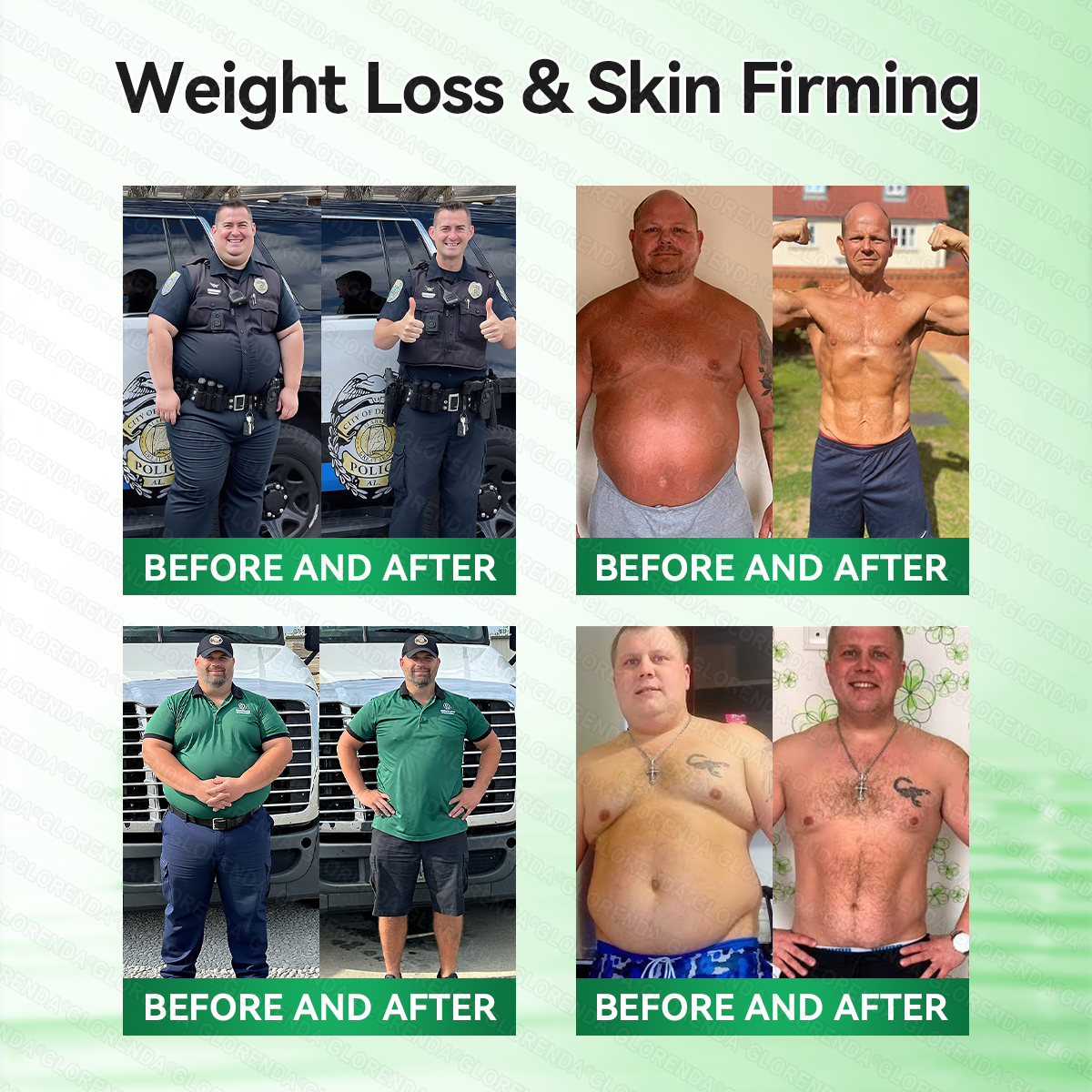 𝑶𝒇𝒇𝒊𝒄𝒊𝒂𝒍 𝑺𝒕𝒐𝒓𝒆 |💎💎𝐆𝑳𝑶𝗥𝗘𝗡𝘿𝘼® 𝙈𝒐𝒓𝒊𝒏𝒈𝗮 · 𝗕𝗲𝗿𝗯𝐞𝐫𝐢𝐧𝙚 × 𝙉𝑨𝑫+ 𝟏𝟎-𝙞𝙣-1 𝘼𝒅𝒗𝒂𝒏𝒄𝒆𝐝 𝐍𝐚𝐧𝙤 𝙈𝙞𝙘𝙧𝙤𝙣𝒆𝒆𝒅𝒍𝐞 𝐏𝐚𝐭𝙘𝙝(𝐉𝐮𝐬𝐭 𝐨𝐧𝐜𝐞 𝐚 𝐝𝐚𝐲, 𝐯𝐢𝐬𝐢𝐛𝐥𝐞 𝐜𝐡𝐚𝐧𝐠𝐞𝐬 𝐢𝐧 𝟕 𝐝𝐚𝐲𝐬） ✅ 𝐅𝐨𝐫 𝐨𝐛𝐞𝐬𝐢𝐭𝐲, 🅛🅞🅞🅢🅔 🅢🅚🅘🅝,𝐝𝐢𝐚𝐛𝐞𝐭𝐞𝐬, 𝐬𝐥𝐞𝐞𝐩 𝐚𝐩𝐧𝐞𝐚, 𝐣𝐨𝐢𝐧𝐭 𝐢𝐬𝐬𝐮𝐞𝐬, 𝐚𝐧𝐝 𝐦𝐨𝐫𝐞